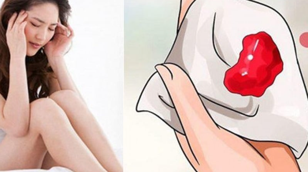 Cục Máu Đông Trong Kỳ Kinh Nguyệt: Bình Thường Hay Cảnh Báo Nguy Hiểm?