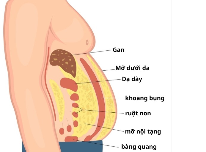 Mỡ nội tạng nguy hiểm hơn mỡ dưới da như thế nào? - Ảnh 1.