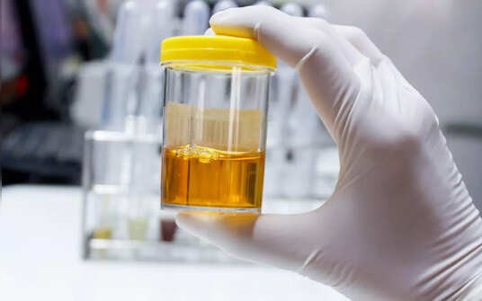 5 biện pháp tự nhiên hỗ trợ đào thải sỏi thận và giảm nguy cơ tái phát - Ảnh 2.