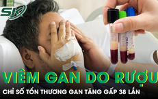 Câu Chuyện Cảnh Giác Về Một Người Đàn Ông Mang Sán Dây Trong Cơ Thể Suốt 12 Năm