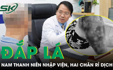 Khám Phá Ba Loại Cá Giá Rẻ Tại Việt Nam: Lợi Ích Đáng Ngạc Nhiên