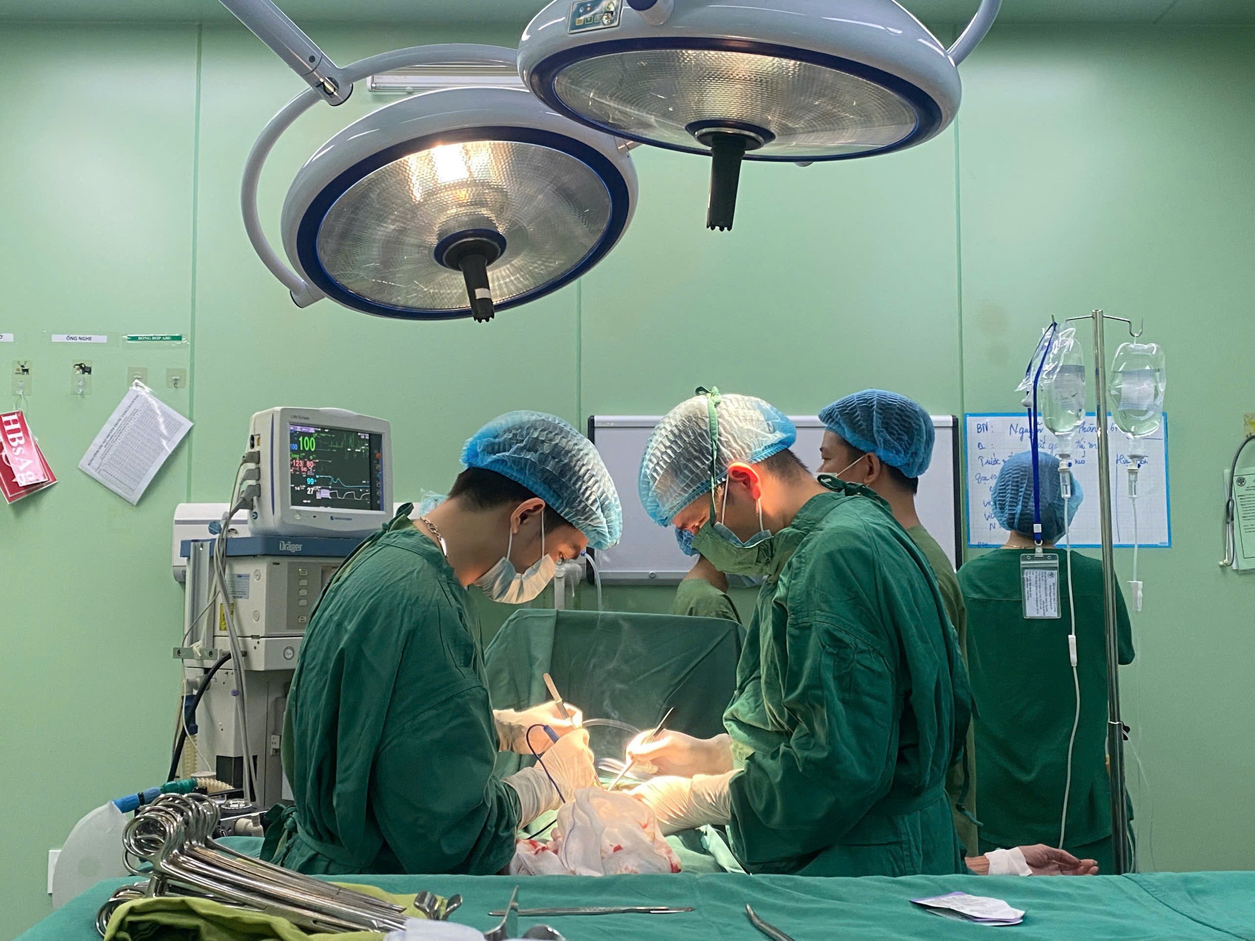 Người đàn ông hai lần thủng ruột vì cùng một nguyên nhân- Ảnh 1.