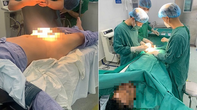 Gãy dương vật sau cú va chạm bất ngờ khi quan hệ