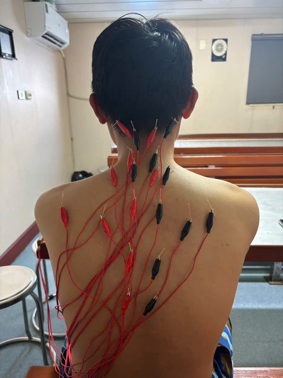 Chăm Sóc Sức Khỏe Quân Và Dân Trường Sa Qua Y Học Cổ Truyền
