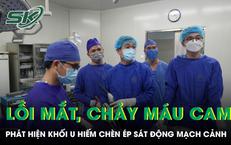 Nguy Hiểm Từ Ong Vò Vẽ: Câu Chuyện Sinh Tử Của Một Người Đàn Ông