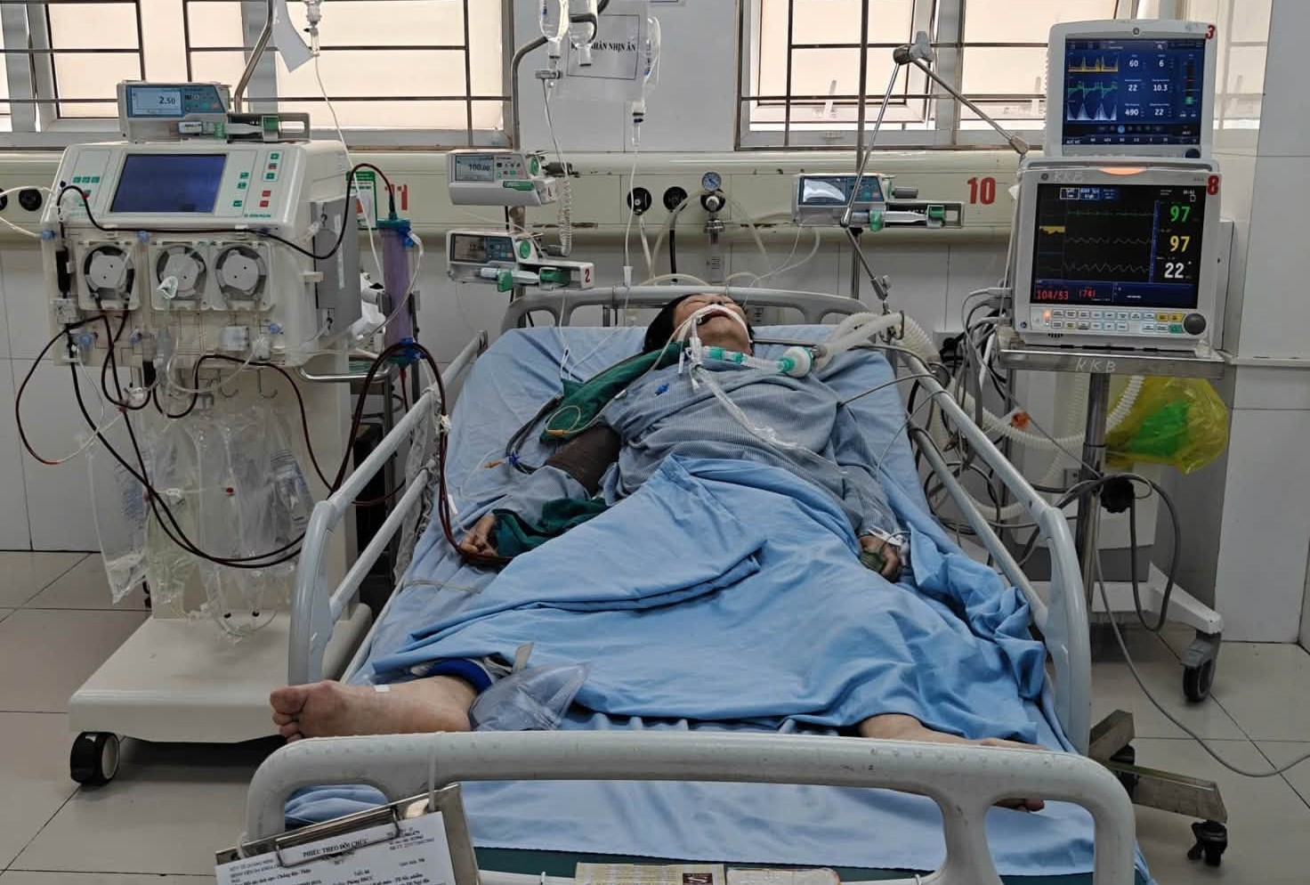 Hành Trình 23 Ngày Cứu Sống Bệnh Nhân Sốc Nhiễm Khuẩn Nghiêm Trọng - Ảnh 1.