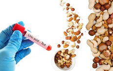 Cách Theo Dõi Đau Nửa Đầu Liên Quan Đến Kỳ Kinh và Thời Tiết