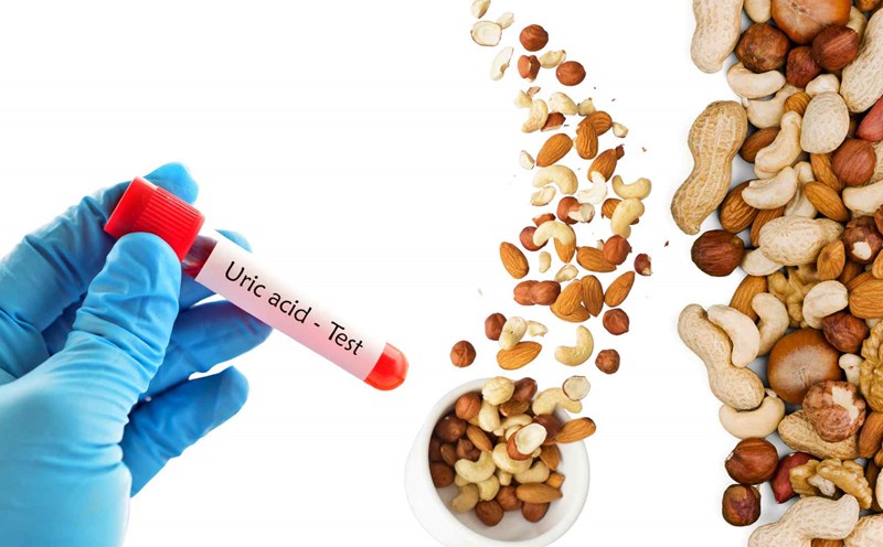 Những Thói Quen Gây Tăng Acid Uric Máu Mà Bạn Nên Biết