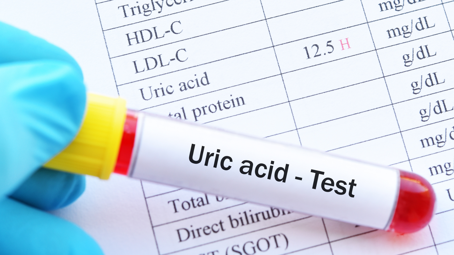 axituric-17859089701671270140816 Tăng acid uric có làm suy giảm ‘bản lĩnh’ nam giới? - Ảnh 1.