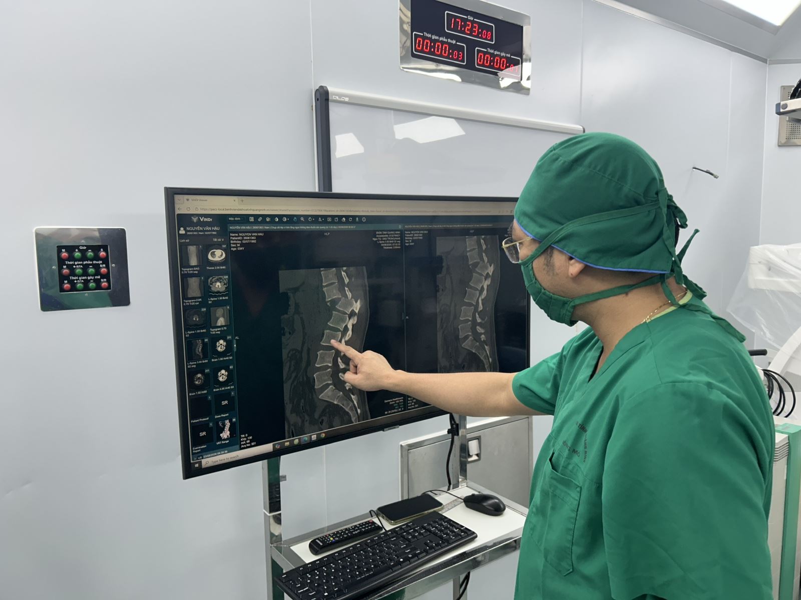 Bác sĩ đánh giá tình trạng trượt hoàn toàn đốt sống của bệnh nhân H. qua phim chụp cắt lớp. Ảnh: BVCC