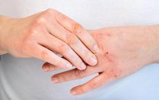 Có Thể Sống Thọ Như Người Khỏe Mạnh: Sự Thật Về Người Nhiễm HIV