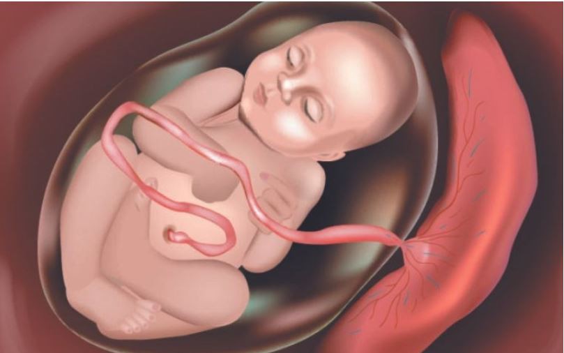 Khám Phá Trường Hợp Hiếm Về Nhau Cài Răng Lược Ở Sản Phụ Chưa Mổ