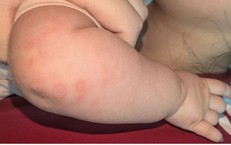 Dịch Vụ Lưu Giữ Tế Bào Gốc: Đầu Tư Cho Tương Lai Sức Khỏe Của Trẻ Em