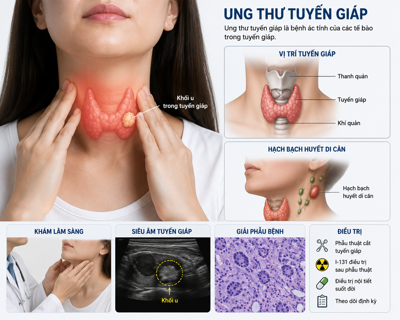 dieu-tri-ung-thu-tuyen-giap-1785045496489424129158 Ai Nên Nhận Điều Trị I-131 Sau Phẫu Thuật Ung Thư Tuyến Giáp? - Ảnh 1.