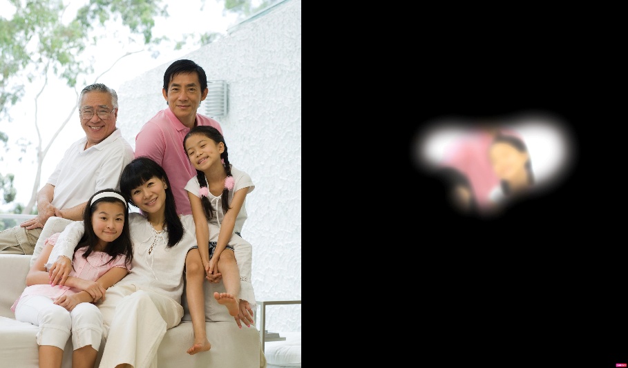 Cảnh Báo Nguy Cơ Mất Thị Lực Do Glaucoma: Những Điều Cần Biết
