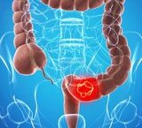 Giải Quyết Tình Trạng Bí Tiểu ở Người Cao Tuổi: Cách Tiếp Cận Hiệu Quả