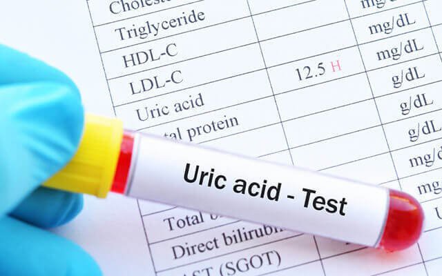 Lợi Ích và Tác Động Của Nước Chanh Mật Ong Đến Nồng Độ Acid Uric - Ảnh 3.