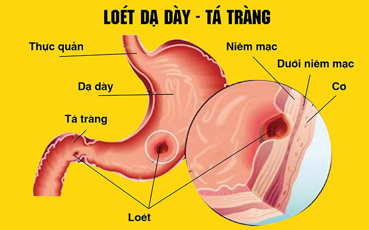 Khám Phá Cây Xấu Hổ: Tác Dụng và Bài Thuốc Hữu Ích