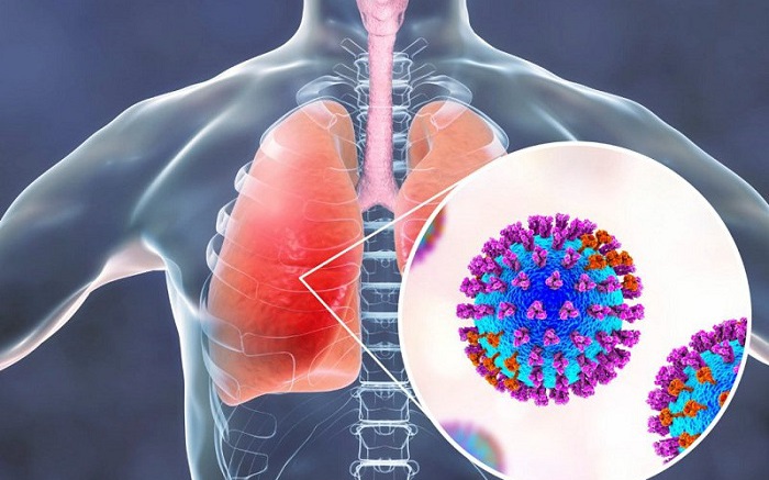 Những Dấu Hiệu Cảnh Báo Viêm Phổi Do Adenovirus Ở Trẻ Em