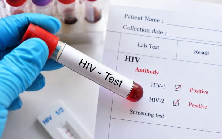 HIV có thể được phát hiện sớm như thế nào?