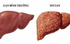 Cách Làm Việc Ca Đêm Ảnh Hưởng Đến Sức Khỏe và Biện Pháp Giảm Tác Động